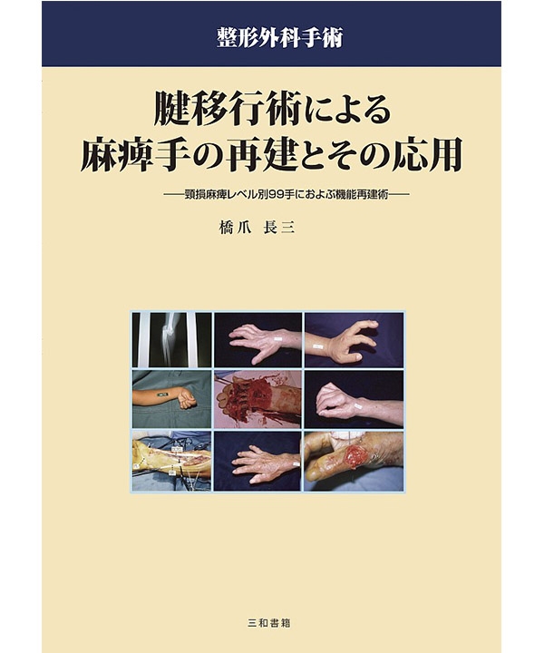 腱移行術による麻痺手の再建とその応用